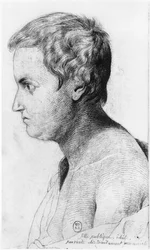 Idiotic prostitute suffering from syphilis, illustration from an unpublished treatise by Jean Etienne Dominique Esquirol on the lunatics of the Salpetriere asylum